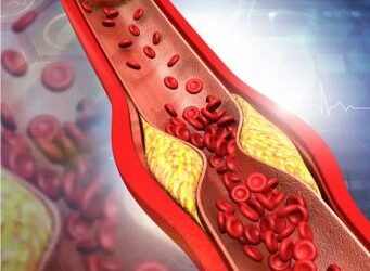 National Vascular Associates